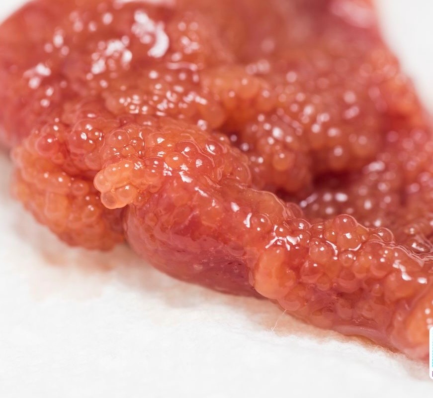 Frozen Food
